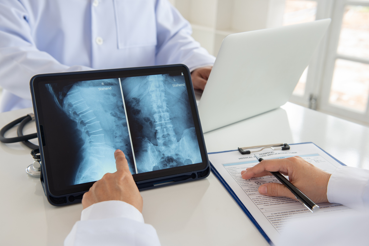 Doctor analyzing a back MRI after a car wreck