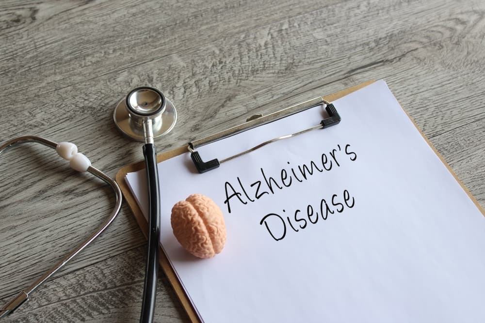 Stethoscope, human brain model and paper clipboard with text Alzheimer's Disease.